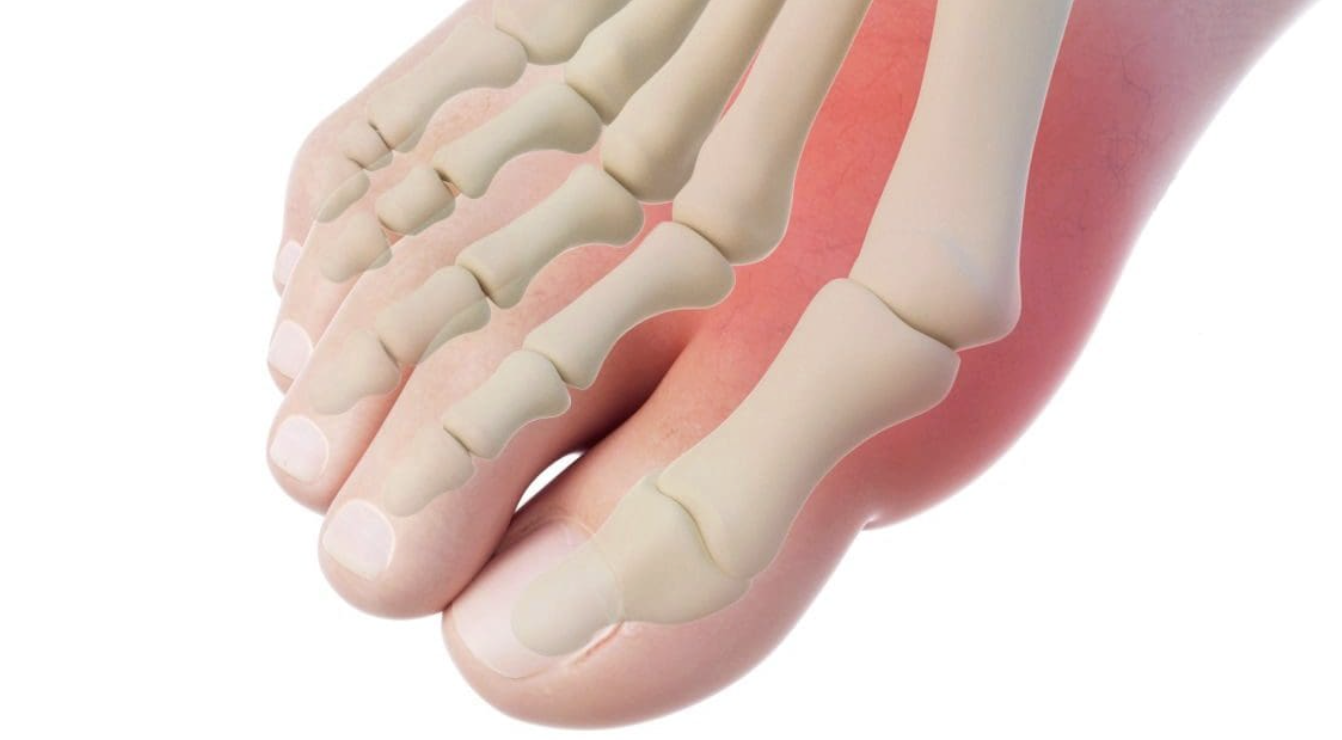 Panduan Memilih Sepatu Trendi yang Ramah Kaki